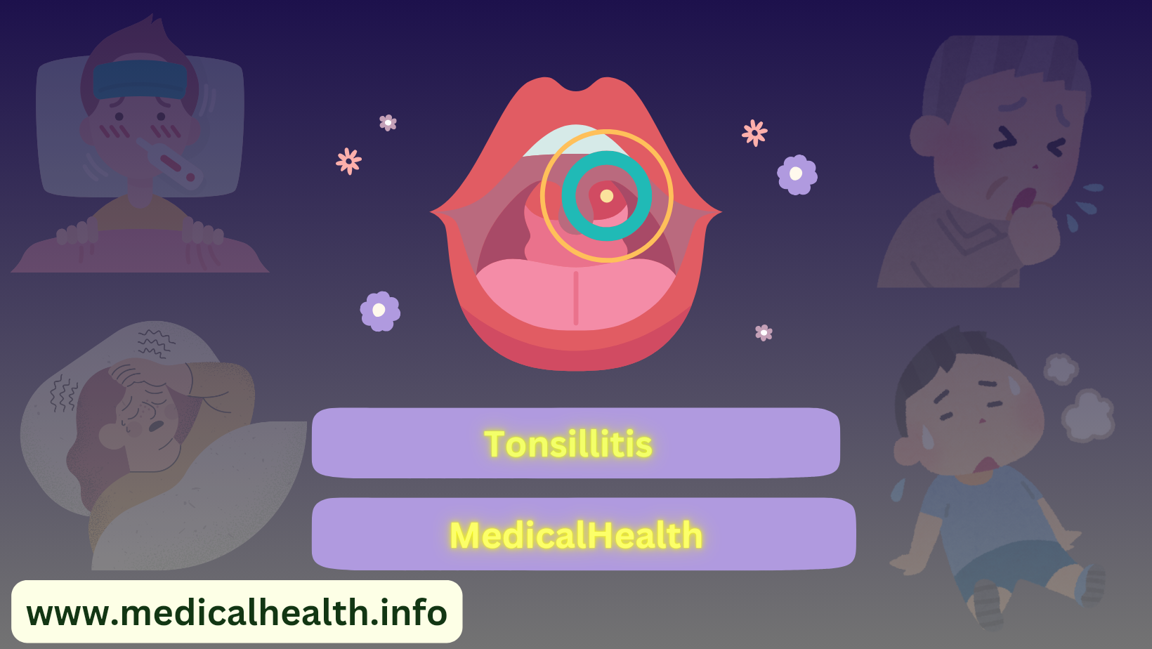 Tonsillitis (هەوکردنی ئاڵوەکان)