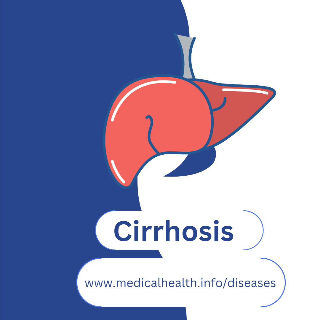 Cirrhosis